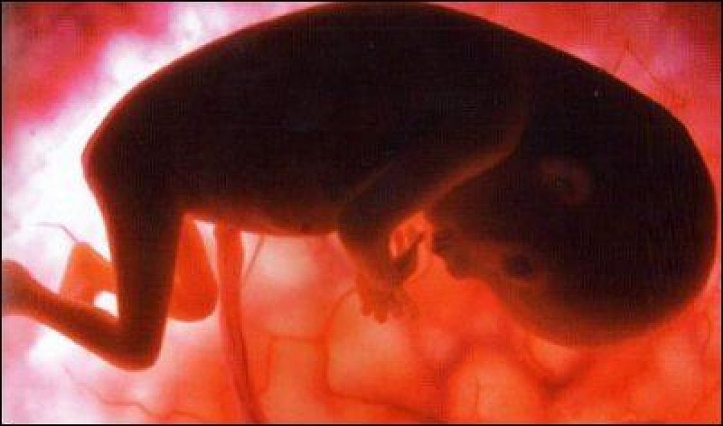 14 недель б. Эмбрион на 14 неделе беременности. Плод на 14 неделе беременности. Малыш в 14 недель беременности в утробе. Ребёнок на 14 неделе беременности.